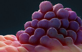 Anya Plutynski : “Parler du cancer comme d’une ‘maladie génétique’ peut être très trompeur”